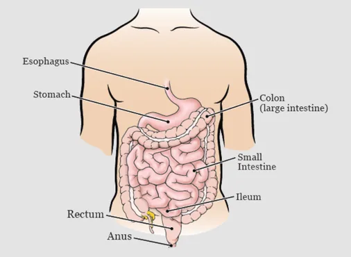 Low Anterior Resection (LAR) - Rectal Cancer Surgery consultation at Niraaya Hospital